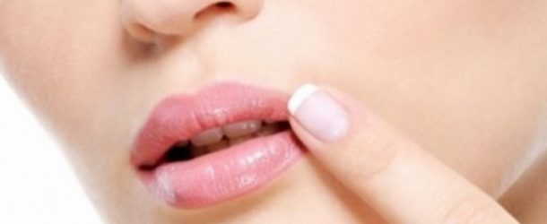 Curar rápido el herpes labial